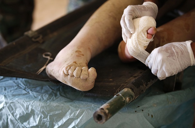 A close up shot shows the hands of a member of the Iraqi forces tending to a civilian who was injured by Islamic State (IS) group militants at a school turned hospital in western Mosul on March 24, 2017. PHOTO: AFP