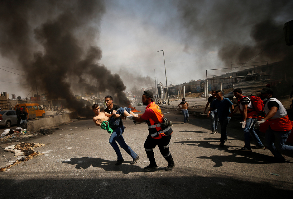 A wounded Palestinian protester is evacuated during clashes at a protest in support of Palestinian prisoners on hunger strike in Israeli jails, near Qalandiya checkpoint near the West Bank city of Ramallah. PHOTO: REUTERS