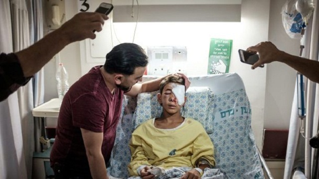palestinian teen loses eye from bullet fired by israeli police