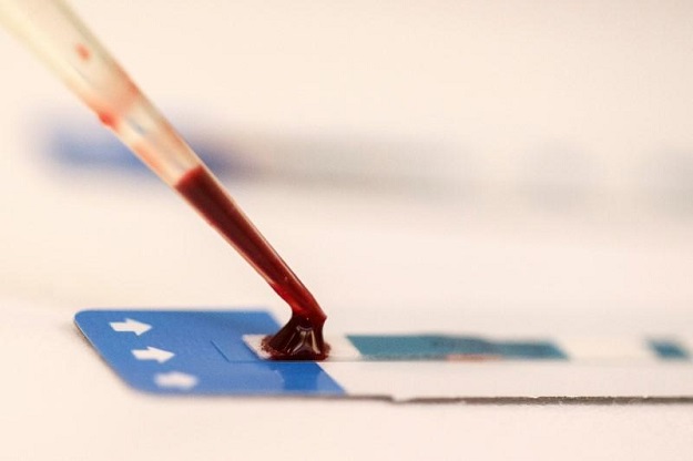 A nurse tests a blood sample. PHOTO: REUTERS