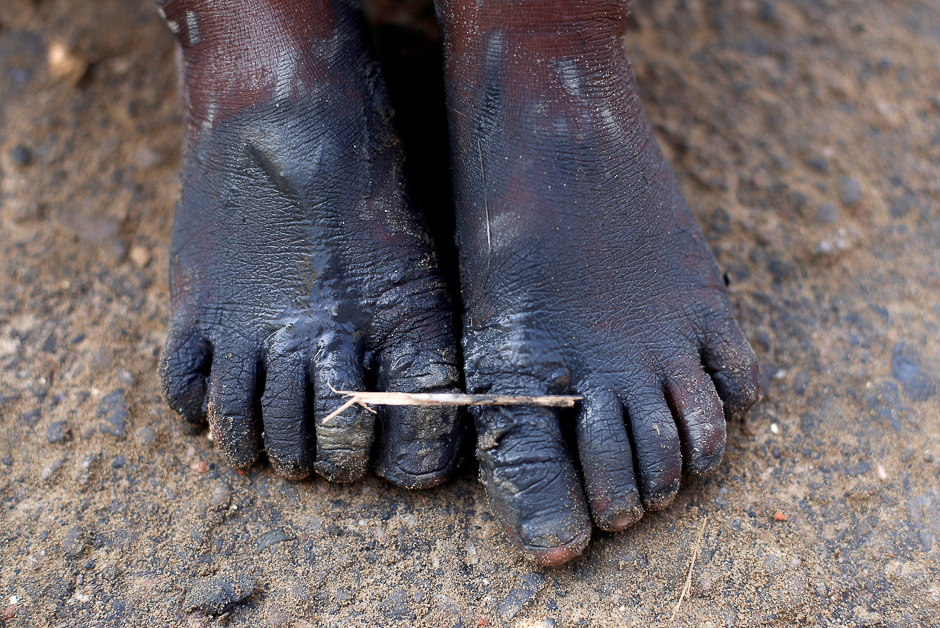 A Rohingya refugee boy's feet are covered with mud after crossing the Bangladesh-Myanmar border, at a port in Teknaf, Bangladesh. PHOTO: REUTERS