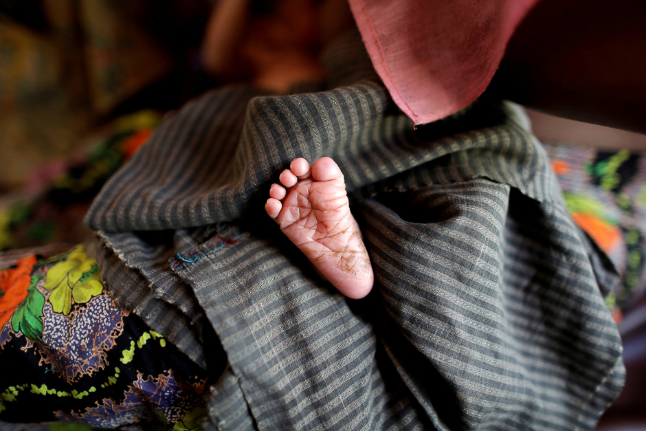 A foot of the new born Rohingya baby is pictured at a medical center in Kutupalong refugees camp in Cox's Bazar, Bangladesh. PHOTO: REUTERS