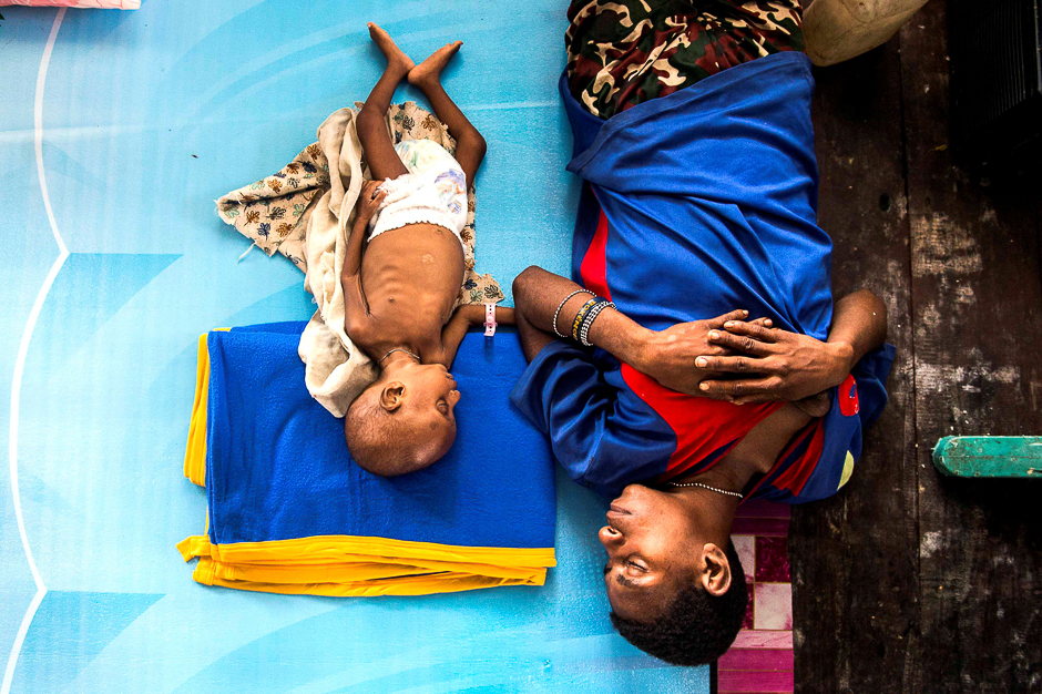 A mother and her three year-old sick child sleep inside a protestant church in Agats, Asmat District, after the government dispatched military and medical personnel to combat malnutrition and measles, Indonesia. PHOTO: REUTERS