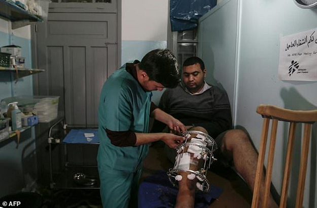 MSF has treated more than 4,000 Plaestinians with gunshots wounds. PHOTO: AFP