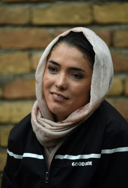 Cyclist Kobra Samim took part in the #MyRedLine campaign that aims to protect womenâs hard-won advancements in Afghanistan. PHOTO: AFP