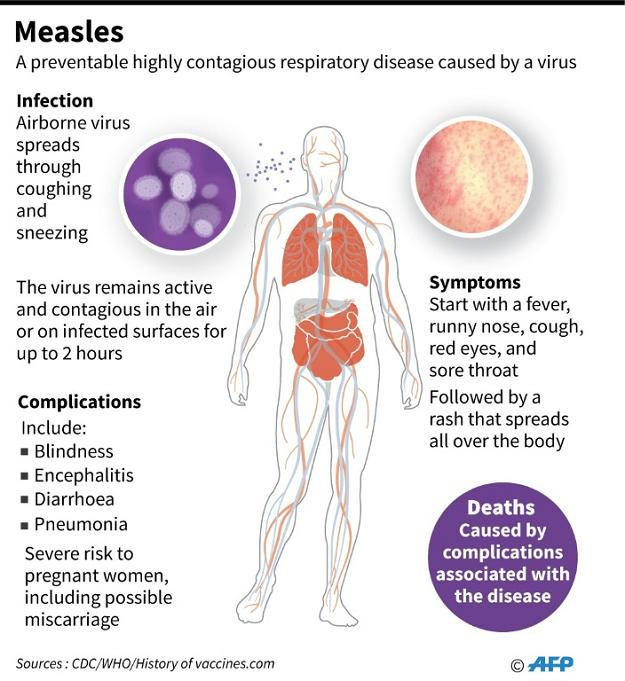US measles 2