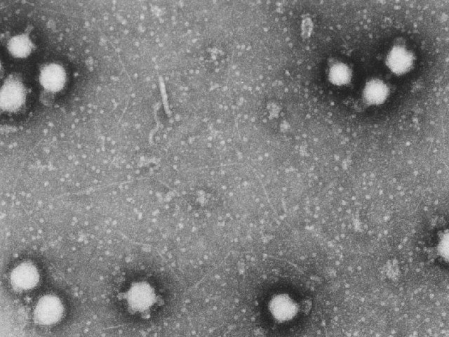 congo virus claims five more lives in sindh