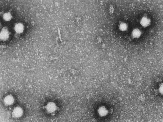 congo virus claims another life