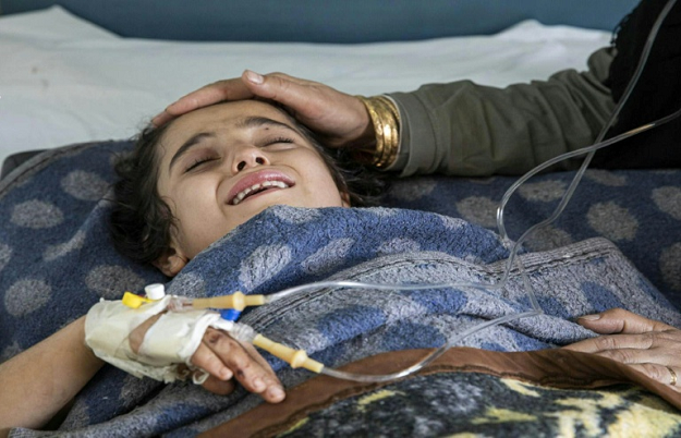 A girl wounded in the Turkish offensive against Kurdish-controlled northeastern Syria lies in a hospital bed in Tal Tamr, near the flashpoint border town of Ras al-Ain. PHOTO: AFP