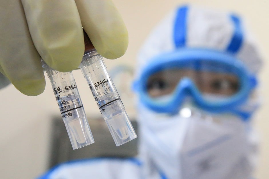 This photo shows a laboratory technician holding samples of virus at a laboratory in Hengyang in China's central Henan province. PHOTO: AFP