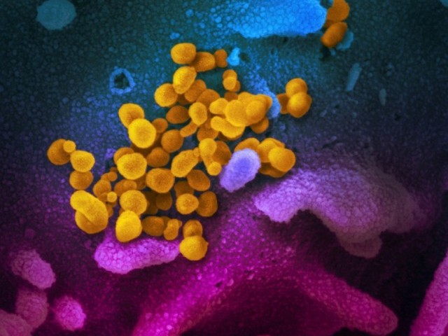 An image taken with a scanning electron microscope shows SARS-CoV-2 (yellow), also known as 2019-nCoV, the virus that causes Covid-19. PHOTO: AFP
